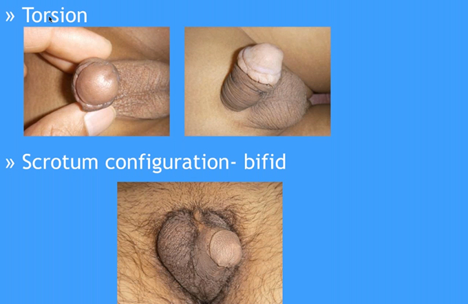 REF Susbcription